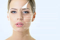 Hydraneedling